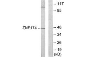 Western blot analysis of extracts from HeLa cells, using ZNF174 Antibody. (ZNF174 antibody  (AA 201-250))