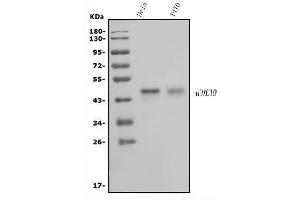 Western blot analysis of HOXC10 using anti-HOXC10 antibody (ABIN7599157).