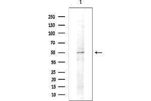 anti-Pyruvate Dehydrogenase Kinase 1 (PDK1) antibody