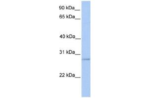ORAI2 antibody used at 1 ug/ml to detect target protein. (ORAI2 antibody  (Middle Region))