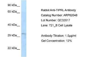 Western Blotting (WB) image for anti-TIP41-like protein (TIPRL) (N-Term) antibody (ABIN2788999) (TIPRL antibody  (N-Term))