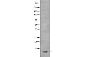 Western blot analysis SNAPC5 using HepG2 whole cell lysates (SNAPC5 antibody  (Internal Region))