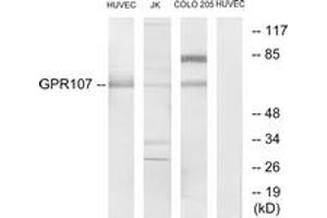 Western blot analysis of extracts from HuvEc/Jurkat/COLO205 cells, using GPR107 Antibody. (GPR107 antibody  (AA 141-190))