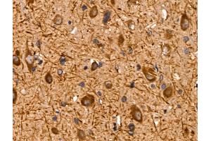 ABIN6259869 and ABIN6267009 at 1/100 staining Rat brain tissue by IHC-P. (AKT 1/2/3 antibody  (C-Term, pan))