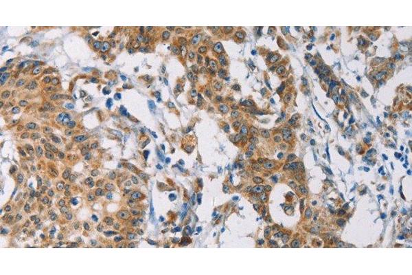 CERK antibody