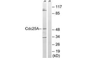 Western blot analysis of extracts from Jurkat cells, using CDC25A (Ab-178) Antibody. (CDC25A antibody  (AA 144-193))
