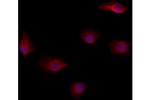 ABIN6264573 and ABIN6278624 staining Hela by IF/ICC.