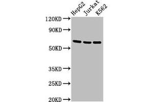 Western Blot Positive WB detected in: HepG2 whole cell lysate, Jurkat whole cell lysate, K562 whole cell lysate All lanes: TNFRSF9 antibody at 2. (CD137 antibody  (AA 24-186))