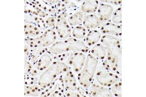 Immunohistochemistry of paraffin-embedded mouse kidney using A Rabbit pAb (ABIN6129868, ABIN6136479, ABIN6136480 and ABIN6221034) at dilution of 1:100 (40x lens). (BAF53A antibody  (AA 1-280))