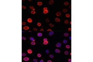 Immunofluorescence analysis of C6 cells using SUN2 antibody (ABIN7270136) at dilution of 1:100. (SUN2 antibody)