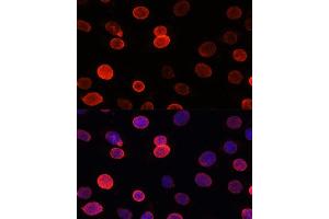 Immunofluorescence analysis of C6 cells using SUN2 antibody (ABIN7270136) at dilution of 1:100. (SUN2 antibody)