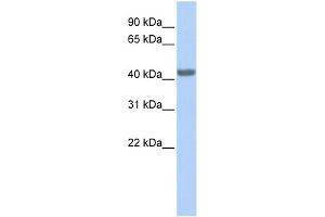WB Suggested Anti-CCR2 Antibody Titration: 0. (CCR2 antibody  (Middle Region))