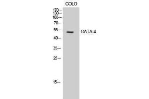 Western Blotting (WB) image for anti-GATA Binding Protein 4 (GATA4) (Ser422) antibody (ABIN3175228) (GATA4 antibody  (Ser422))