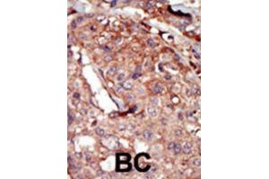 Immunohistochemistry (IHC) image for anti-Bromodomain Containing 2 (BRD2) antibody (ABIN3003651) (BRD2 antibody)