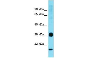 Western Blotting (WB) image for anti-RAB31, Member RAS Oncogene Family (RAB31) (Middle Region) antibody (ABIN2788973) (RAB31 antibody  (Middle Region))