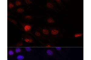 Immunofluorescence analysis of C6 cells using KLHL8 Polyclonal Antibody at dilution of 1:100. (KLHL8 antibody)