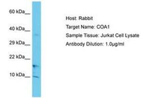 Image no. 1 for anti-UBX Domain Protein 11 (UBXN11) (C-Term) antibody (ABIN6750641)