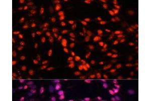 Immunofluorescence (IF) image for anti-Minichromosome Maintenance Complex Component 5 (MCM5) antibody (ABIN7257096)