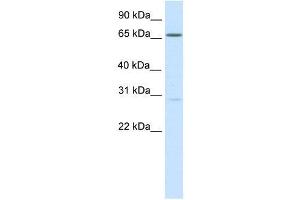 Western Blot showing NFAT5 antibody used at a concentration of 1-2 ug/ml to detect its target protein. (NFAT5 antibody  (Middle Region))
