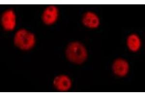 ABIN6277385 staining Hela cells by IF/ICC. (HOXC8 antibody  (Internal Region))