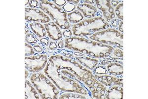 Immunohistochemistry of paraffin-embedded Rat kidney using Alpha-tubulin (ubiquitous) chain antibody (ABIN7271033) at dilution of 1:50 (40x lens). (TUBA1B antibody  (AA 1-451))