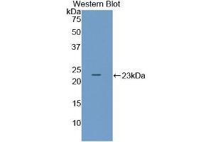 Detection of Recombinant ADCYAP1, Mouse using Polyclonal Antibody to Pituitary Adenylate Cyclase Activating Peptide (PACAP) (Pituitary Adenylate Cyclase Activating Peptide (AA 1-175) antibody)