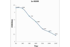 Epstein-Barr Virus Nuclear Antigen-3A (EBNA-3A) antibody