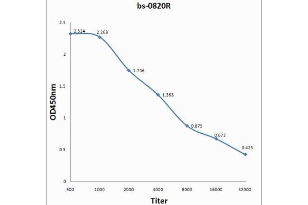 Epstein-Barr Virus Nuclear Antigen-3A (EBNA-3A) antibody