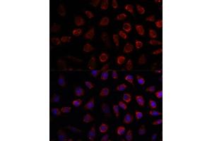 Immunofluorescence analysis of L929 cells using PDE11A antibody (ABIN7269298) at dilution of 1:100. (PDE11A antibody  (AA 712-933))