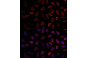 Immunofluorescence analysis of L929 cells using PDE11A antibody (ABIN7269298) at dilution of 1:100. (PDE11A antibody  (AA 712-933))