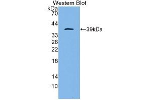 Detection of Recombinant C5a, Rat using Polyclonal Antibody to Complement Component 5a (C5a) (C5A antibody  (AA 1-77))