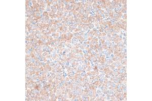 Immunohistochemistry of paraffin-embedded rat ovary using PMEP antibody (6555) at dilution of 1:100 (40x lens). (PMEPA1 antibody  (AA 173-252))
