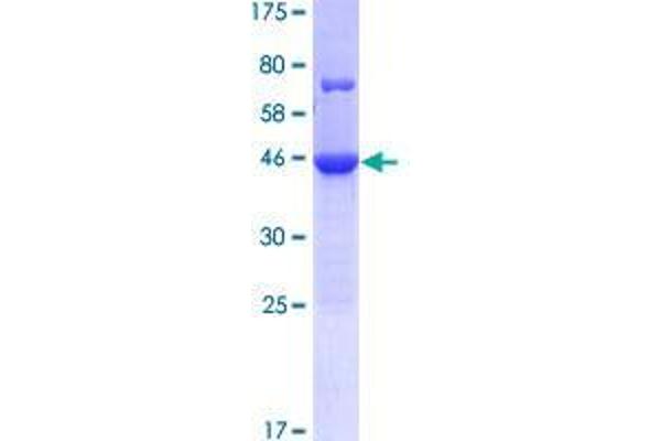 CCDC117 Protein (AA 1-170) (GST tag)