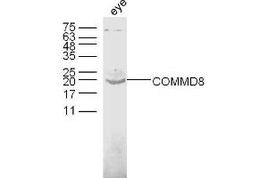 Mouse eye lysates probed with COMMD8 Polyclonal Antibody, unconjugated  at 1:300 overnight at 4°C followed by a conjugated secondary antibody at 1:10000 for 60 minutes at 37°C. (COMMD8 antibody  (AA 101-183))