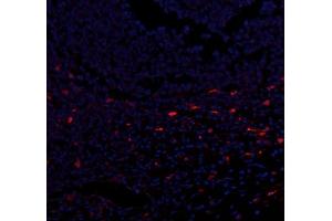 IF analysis of CXCL12 using anti-CXCL12 antibody (ABIN6719467). (CXCL12 antibody  (AA 24-93))