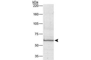 Western blot analysis of BEST1 (68 kDa) from human RPE cell lysate using BEST1 monoclonal antibody, clone E6-6  (1 : 1000).