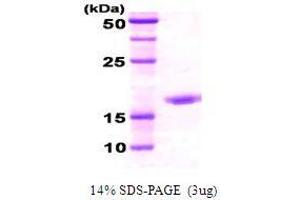 Figure annotation denotes ug of protein loaded and % gel used. (DnaK (AA 508-638) Peptide)