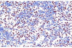 Immunohistochemistry of paraffin-embedded Mouse spleen using PELP1 Polyclonal Antibody at dilution of 1:100 (40x lens). (PELP1 antibody)