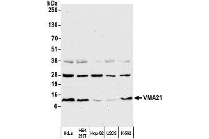 Western Blotting (WB) image for anti-Vacuolar H+-ATPase Homolog (VMA21) (AA 51-101) antibody (ABIN7452645) (VMA21 antibody  (AA 51-101))