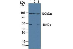 Western blot analysis of (1) Human MCF-7 Cells, (2) Porcine Liver Tissue and (3) Human HeLa cells. (alpha Actinin 4 antibody  (AA 1-269))
