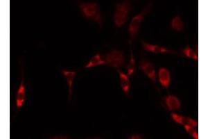 ABIN6274909 staining HeLa by IF/ICC. (B4GALNT1 antibody  (Internal Region))