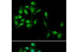 Immunofluorescence analysis of A549 cells using HEXIM1 Polyclonal Antibody (HEXIM1 antibody)
