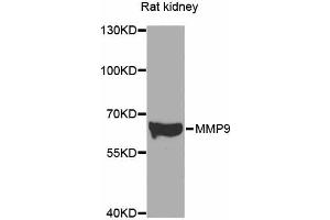 Western blot analysis of extracts of various cell lines, using MMP9 antibody (ABIN4904401) at 1:500 dilution. (MMP 9 antibody)