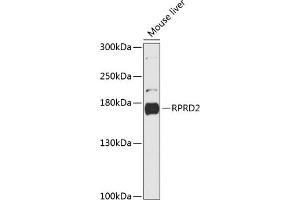Western blot analysis of extracts of mouse liver, using RPRD2 antibody (ABIN6130674, ABIN6147187, ABIN6147188 and ABIN6216935) at 1:3000 dilution. (RPRD2 antibody  (AA 1-350))