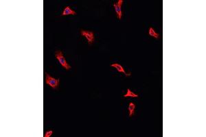 ABIN6268986 staining HeLa cells by IF/ICC. (Annexin A2 antibody  (pSer26))