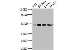 Western Blot Positive WB detected in: PC-3 whole cell lysate, Mouse kidney tissue, Mouse liver tissue, Rat brain tissue All lanes: ACP6 antibody at 3 μg/mL Secondary Goat polyclonal to rabbit IgG at 1/50000 dilution Predicted band size: 49, 31 kDa Observed band size: 49 kDa