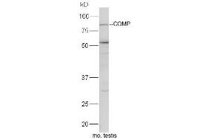 Mouse testis lysates probed with Rabbit Anti-COMP Polyclonal Antibody, Unconjugated  at 1:5000 for 90 min at 37˚C. (COMP antibody)