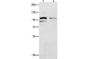 Western blot analysis of 231 cell  and mouse kidney tissue  , using MVP Polyclonal Antibody at dilution of 1:500 (MVP antibody)