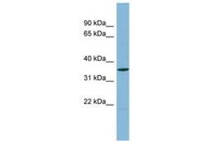 Image no. 1 for anti-Ubiquitin Carboxyl-terminal Hydrolase L5 (UCHL5) (AA 179-228) antibody (ABIN6742045) (UCHL5 antibody  (AA 179-228))