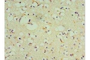 Immunohistochemistry of paraffin-embedded human brain tissue using ABIN7149475 at dilution of 1:100 (DRD3 antibody  (AA 213-329))